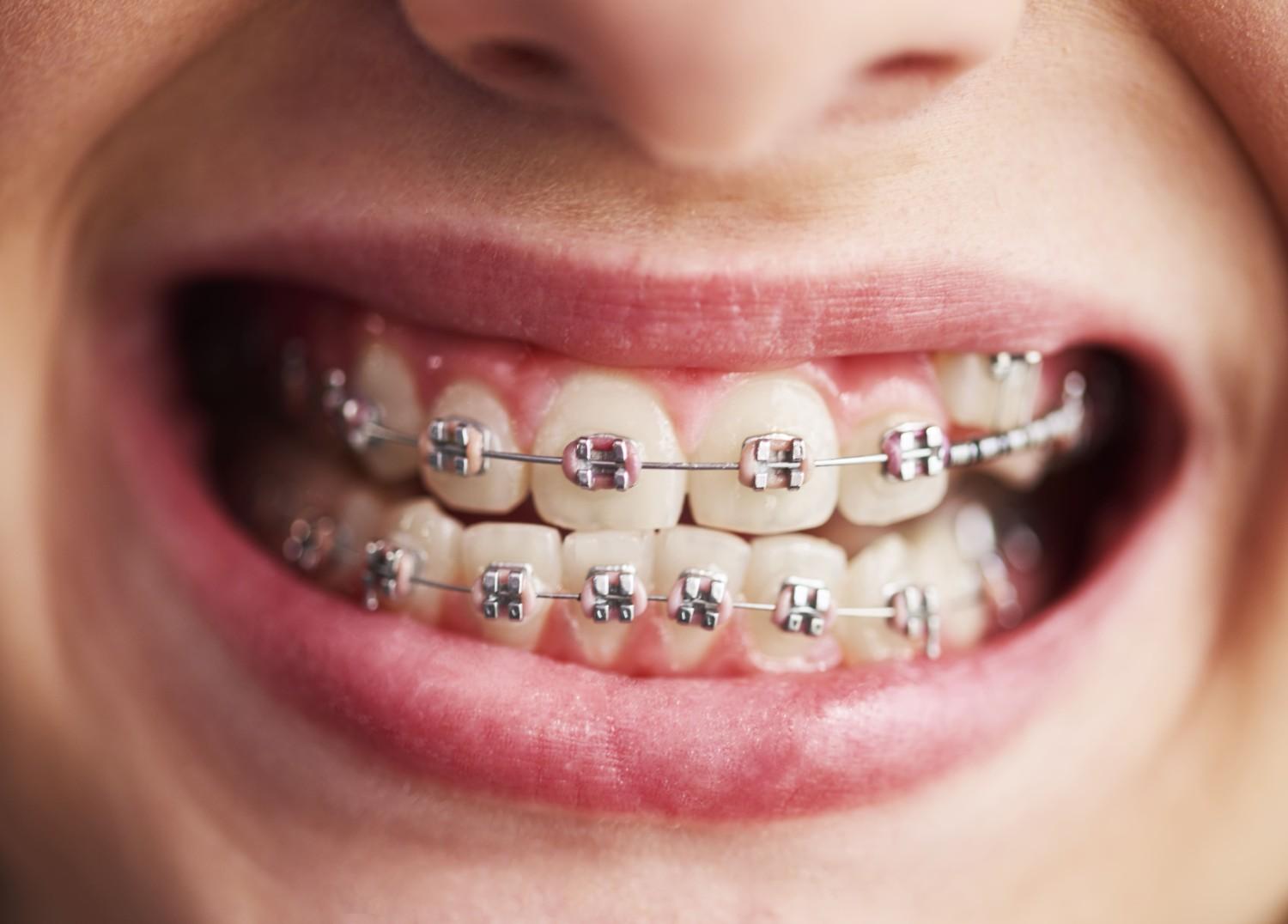 Orthodontic treatment at the clinic
